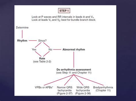 Rapid interpretation of ECG | PDF