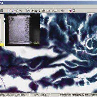 ImageScope Algorithm Software Logo 的图像结果