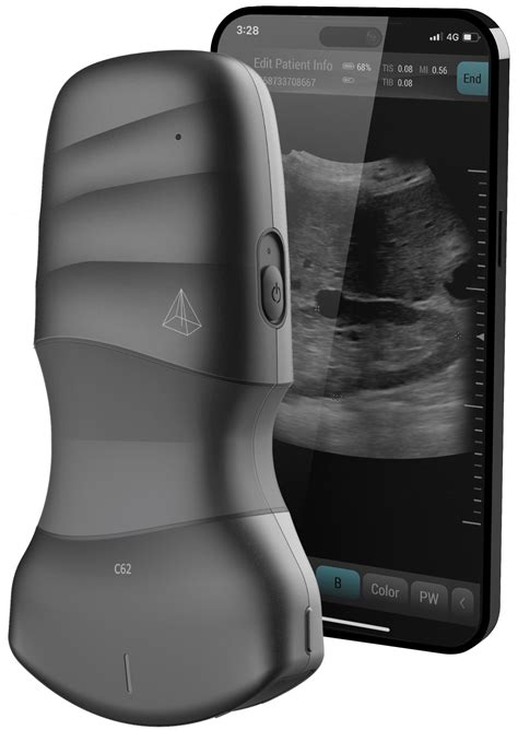Neo Medical Inc: Wireless handheld ultrasound – Neo Medical USA Inc
