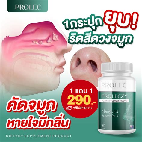 Prolec marigold Relieves Sinus Tiredness Allergic Reactions And Allergies. | Shopee Malaysia