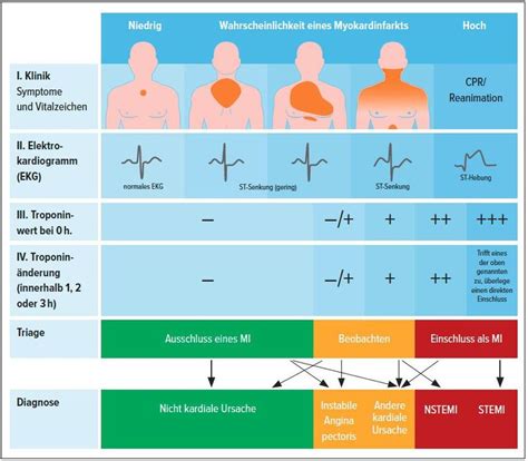 Früherkennung von AMI durch Einsatz schneller Triage-Algorithmen ...