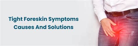 Prépuce serré : symptômes, causes et solutions