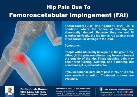Femoroacetabular Impingement Syndrome > Fact Sheets – VNJQN