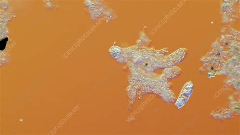 Image result for Amoeba Microscopy
