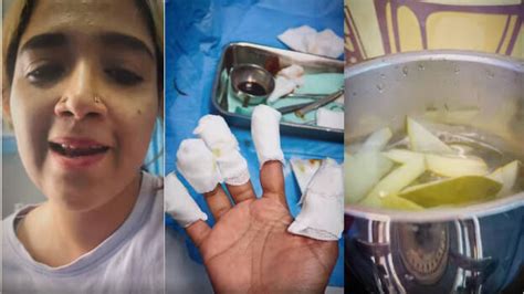 Mixer grinder explodes during food vlogging; singer Abhirami Suresh ...