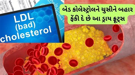Best dry fruits and herbs for get rid of bad cholesterol - બેડ ...