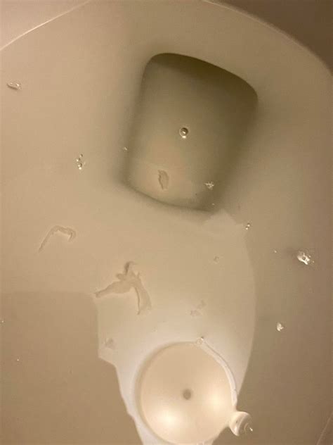 What is this white tissue? In urine with cramping over past two months (been passing small ...