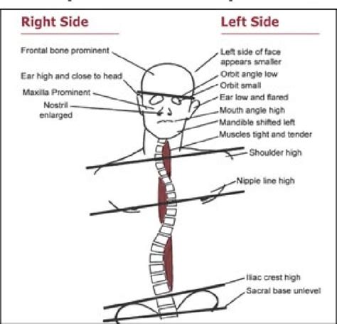 Image result for Common Compensatory Pattern