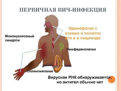 КЛИНИЧЕСКАЯ КЛАССИФИКАЦИЯ ВИЧ-ИНФЕКЦИИ ДИАГНОСТИЧЕСКИЕ КРИТЕРИИ СТАДИЙ ...