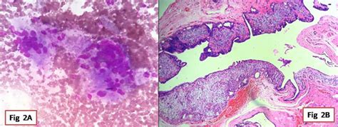 Cytohistological and immunohistochemical correlation of cutaneous ...