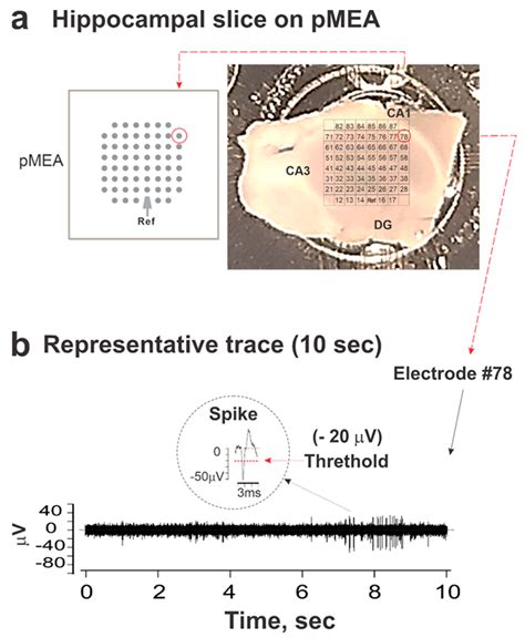 The α4 Nicotinic Acetylcholine Receptor Is Necessary for the Initiation ...