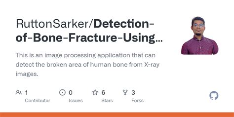 Bone Fracture Detection Using Image Processing Source Code GitHub 的图像结果