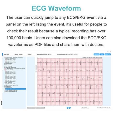 Livenpace 24-hour EKG Holter Monitor with Free AI Analysis India | Ubuy