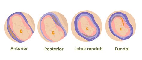 Tips For Feeling Baby Move With Anterior Placenta at Barbara Bowles blog