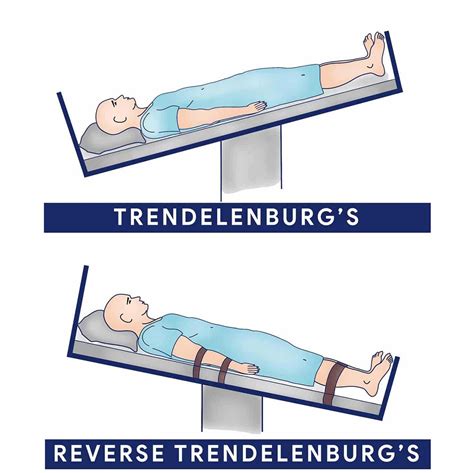 Funzione Trendelenburg / anti Trendelenburg – Kinemed srl | Articoli ...