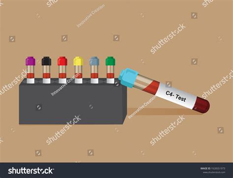 Image result for C4 Complement Blood Test