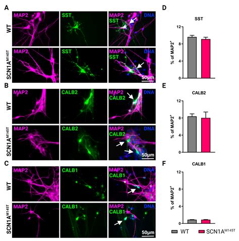 Human iPSC Modeling of Genetic Febrile Seizure Reveals Aberrant ...