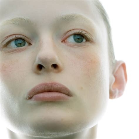 What are the causes of skin xerosis?
