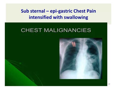 Chest Pain- Differential Diagnosis | PPTX