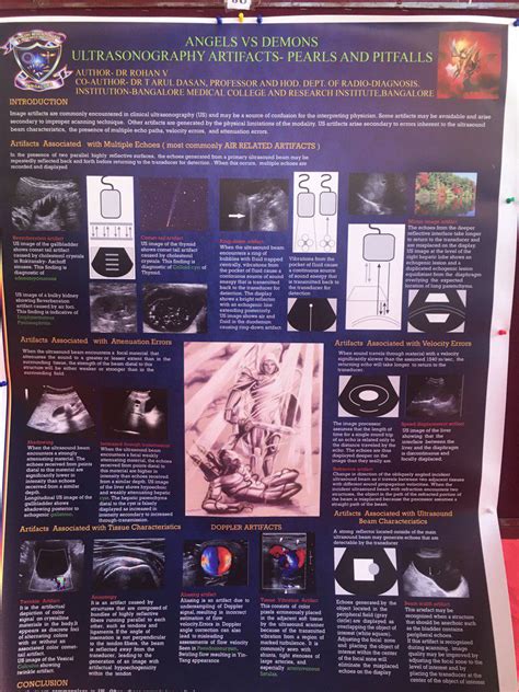Radioloksabha - Articles