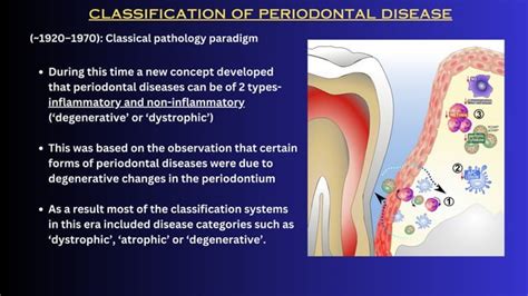 Image result for Classification Periodontitis
