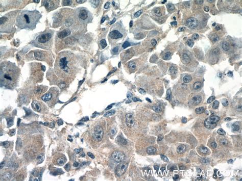 CPEB1 antibody (13274-1-AP) | Proteintech