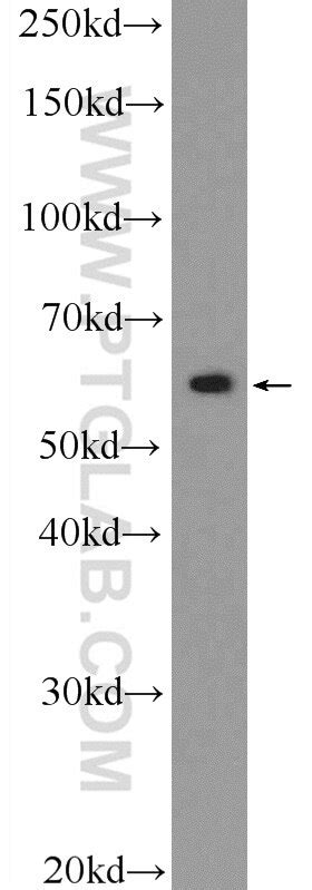 ZBTB22 antibody (25633-1-AP) | Proteintech