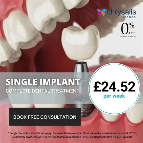 Financing Dental Implants