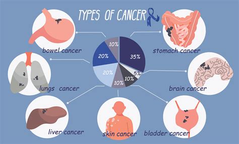 cáncer tipos plano infografia 28704865 Vector en Vecteezy