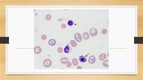 NRBC - Nucleated Red Blood Cells | PPTX