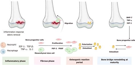 Most vexing problem in pediatric fractures: Epiphyseal fractures
