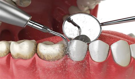 Oral and Maxillofacial Surgery Bhawanipur, Kolkata | Teeth Braces ...