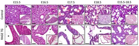 Decreased Expression of Pulmonary Homeobox NKX2.1 and Surfactant ...