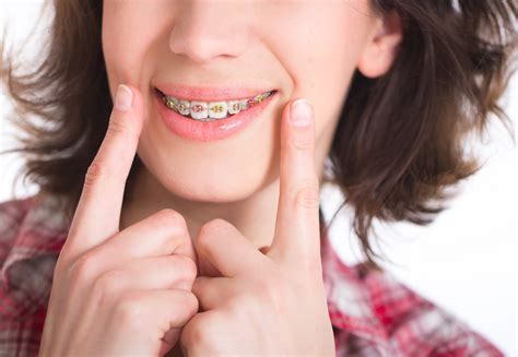 Image result for braces