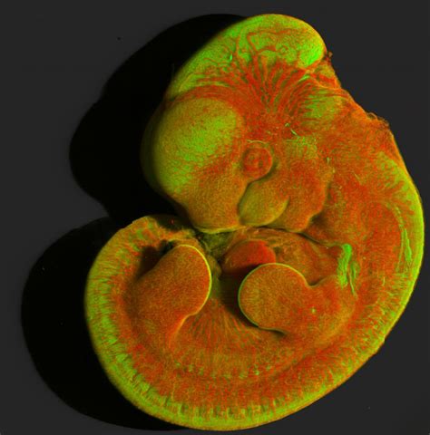 Image result for Mouse Embryo Circulation System Development