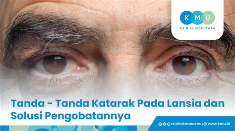 5 Tips agar mata sehat dan fresh