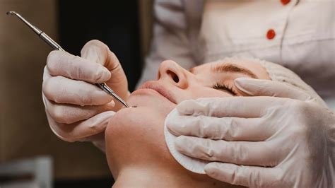 How to Remove Whiteheads: Causes, Remedies & Prevention Tips