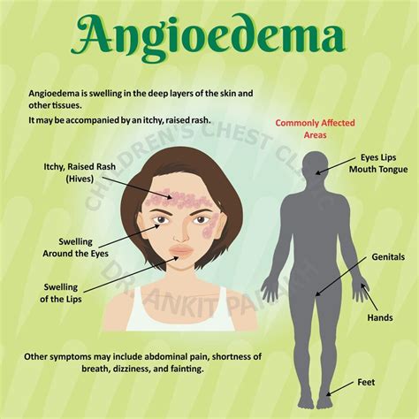 Understanding Angioedema: Causes, Symptoms, And Treatment - Ask The ...