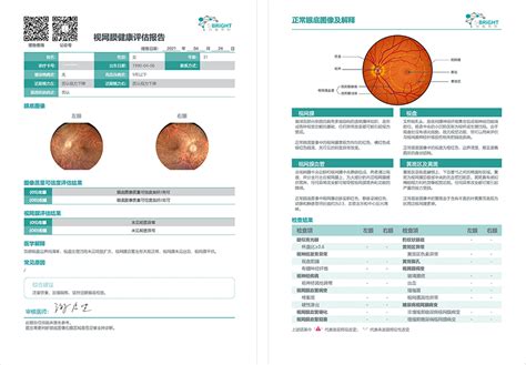 Ai 影像筛查 的图像结果