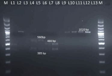 Detection and Identification of Mycobacterium tuberculosis and ...