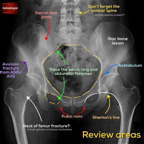 Anatomy Of Pelvic