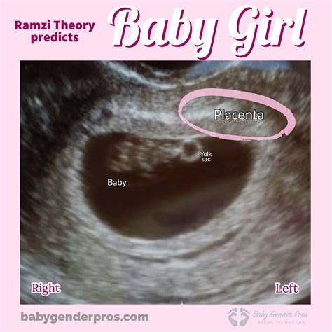 7 Week Ultrasound 2022