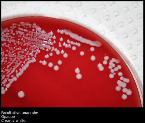 Image result for Staphylococcus Saprophyticus Infection