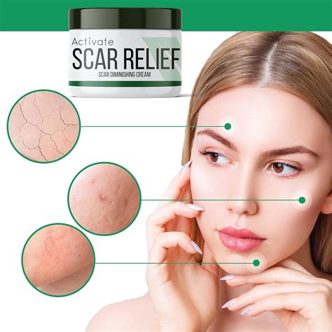 Buy Activate Scar Removal Cream - Natural Healing Treatment for Stretch ...