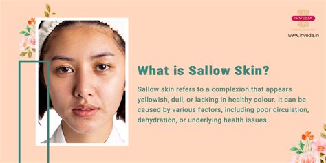 5 Reasons You Are Suffering from Sallow Skin:Simple Ways to treat
