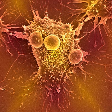 Advanced Understanding of the Hallmarks of Cancer using Real-time Live ...