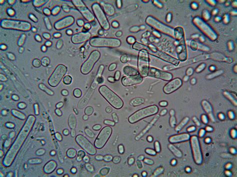 Bacteria Under Microscope
