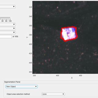 Segmentation Visualization Stack Overflow 的图像结果
