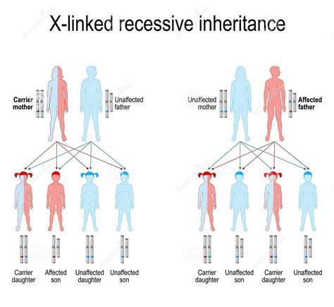 X Linked Gene