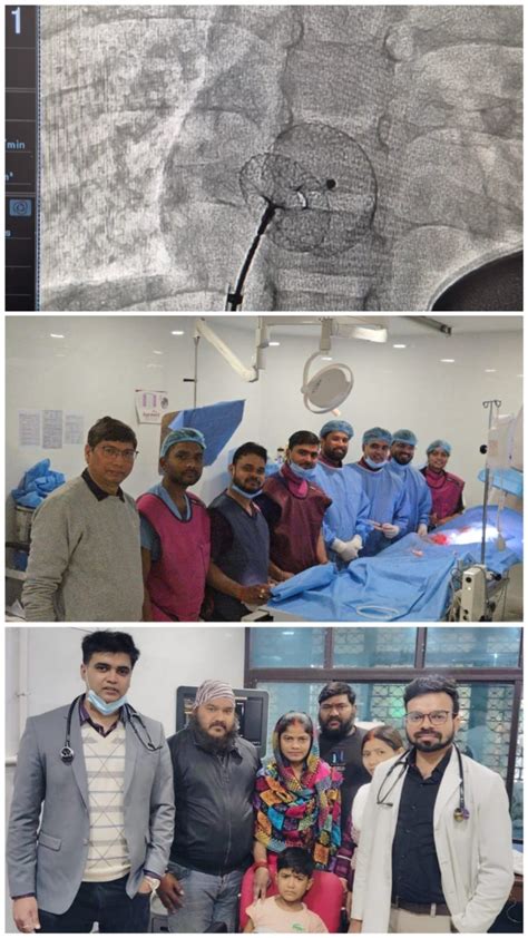 New Directions in Pediatric Cardiology: Successful device closure, 7 ...